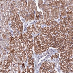 FBXO27 Antibody, Novus Biologicals:Antibodies:Primary Antibodies